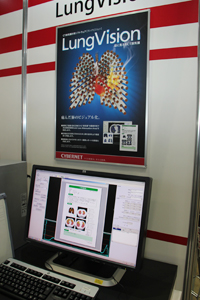 肺気腫計測ソフト「LungVision2」の新機能を紹介