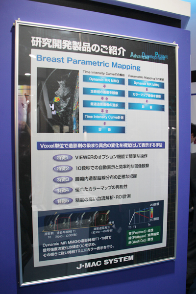 マンモ領域で研究開発中の“Breast Parametric Mapping”を紹介