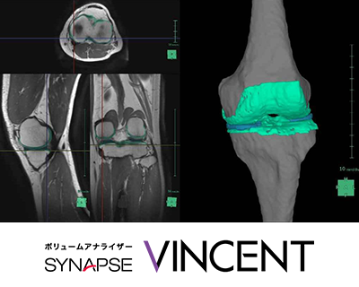 3D解析ワークステーション　SYNAPSE VINCENT　Ver5.0