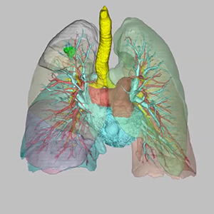 図4：動静脈に加え肺葉も分割表示