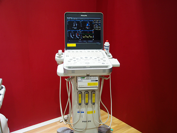 ポータブル型超音波診断装置「CX50  Xper」