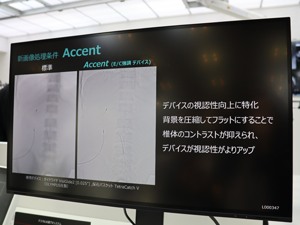 デバイスの強調表示で視認性を高める新たな画像処理条件「Accent」