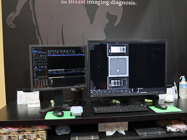 EIZOの12メガモニタと組み合わせた乳腺画像診断ワークステーション「mammodite」