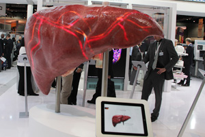 “BodyMRI”をアピールする肝臓の巨大な模型