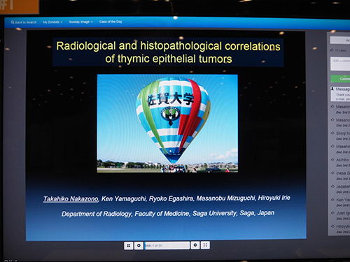 Radiological and Histopathological Correlation of Thymic Epithelial Tumors 中園貴彦（佐賀大学医学部放射線医学教室）