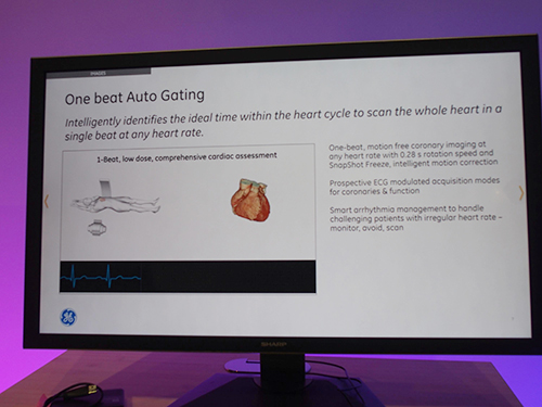 心臓CTの適用を広げる“One beat Auto Gating”