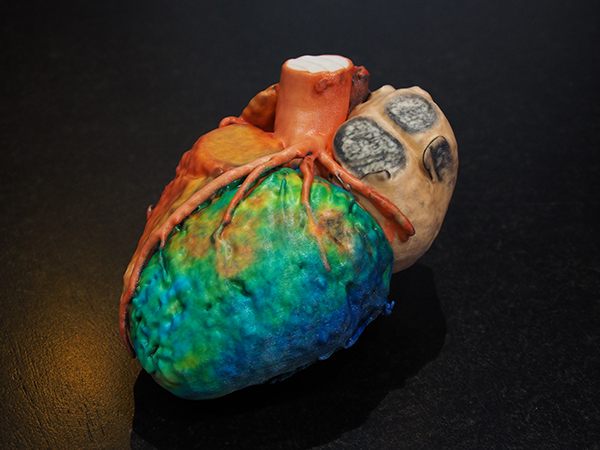 OBJファイル形式で出力された心臓の臓器モデル