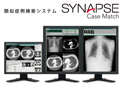 SYNAPSE Case Match