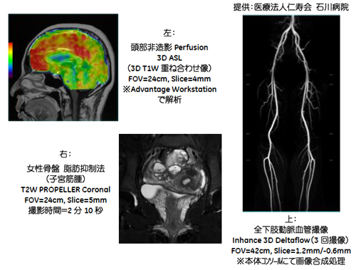 Optima MR360 Advance 1.5Tڂ̎vAvP[VgpBe摜