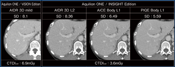 図1　従来CTとAquilion ONE / INSIGHT Editionの画像比較 AiCE：Advanced intelligent Clear-IQ Engine