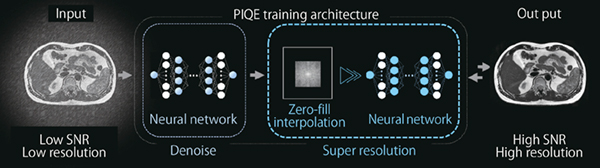 図1　PIQEによるデノイズと超解像処理2つのCNNを使用した処理過程