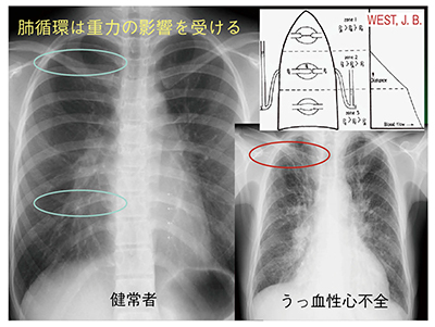 図2　肺循環への重力の影響