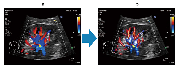 図2　Flow Viewerによる腎臓の血流イメージ：OFF（a）とON（b）