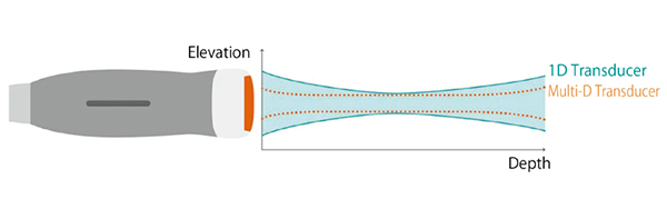 図2　Multi-D技術によるエレベーション方向の超音波ビーム制御