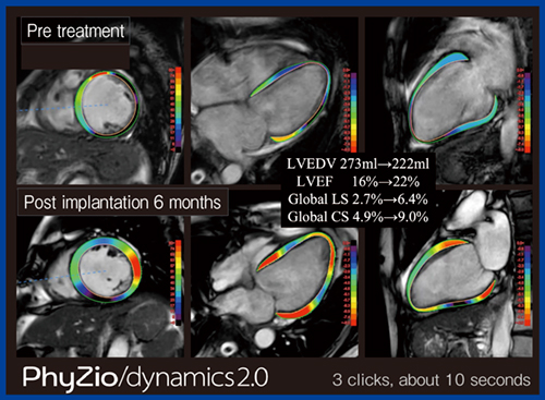 図9　PhyZio/dynamics2.0によるiPS細胞を用いた再生医療の効果判定