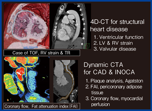 図10　4D-CTによる循環器疾患のマルチパラメトリック解析