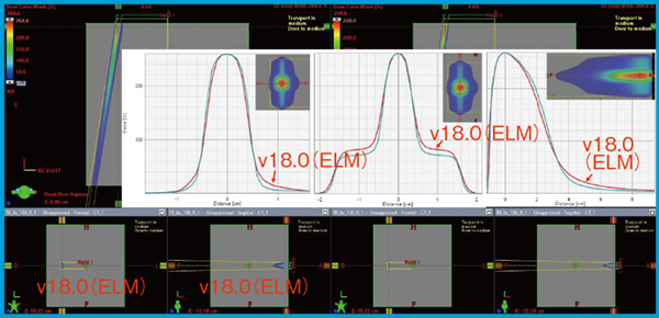 図1　小照射野のMLCギャップを介した軸外線量の計算結果