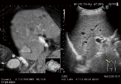Real-time Virtual Sonography
