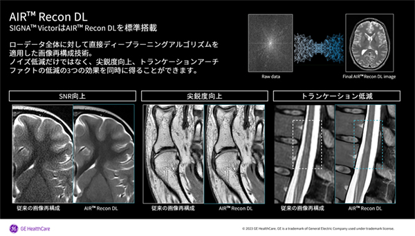 先進のイメージクオリティ