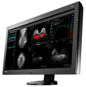 ナナオ デジタルマンモグラフィやct Mriなどの多様な医用画像が表示可能な超高解像度医用液晶モニターを発売