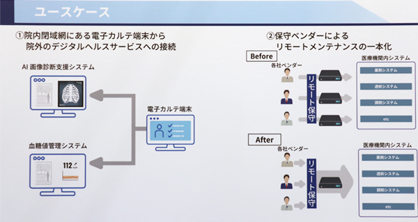 セキュアな院内外接続やリモートメンテナンスの一元化を実現