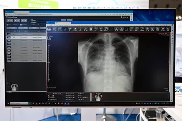 心胸郭比計測などの機能を有するClimisのWeb対応DICOM画像ビューワ